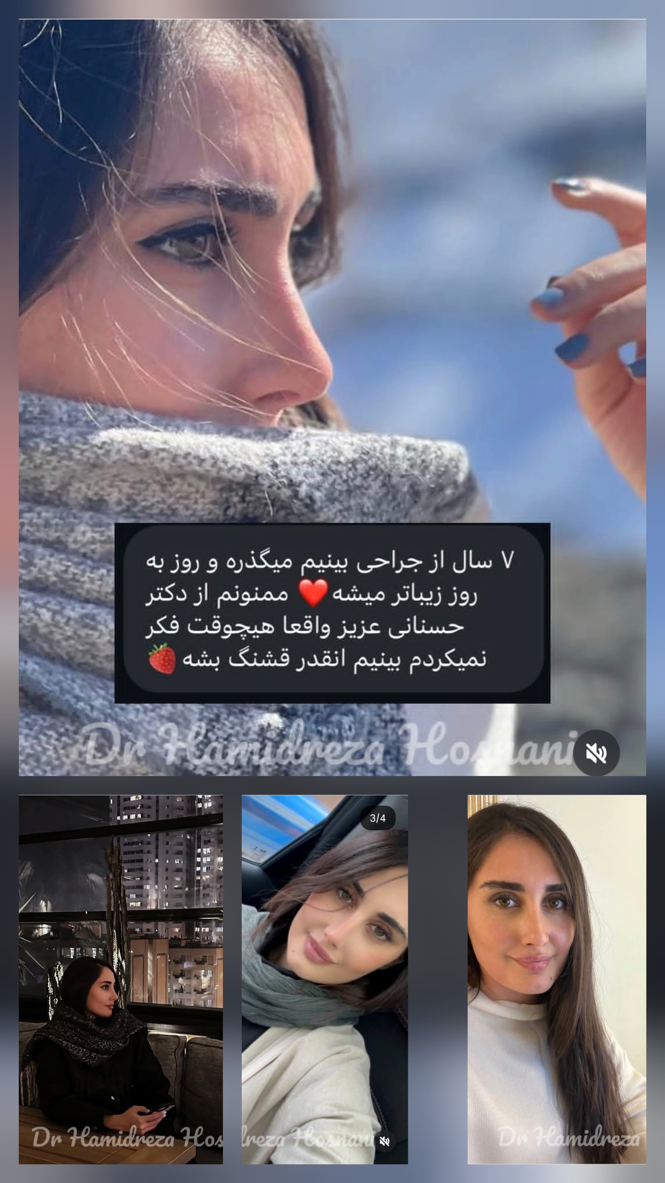 ۷ سال بعد از عمل بینی
