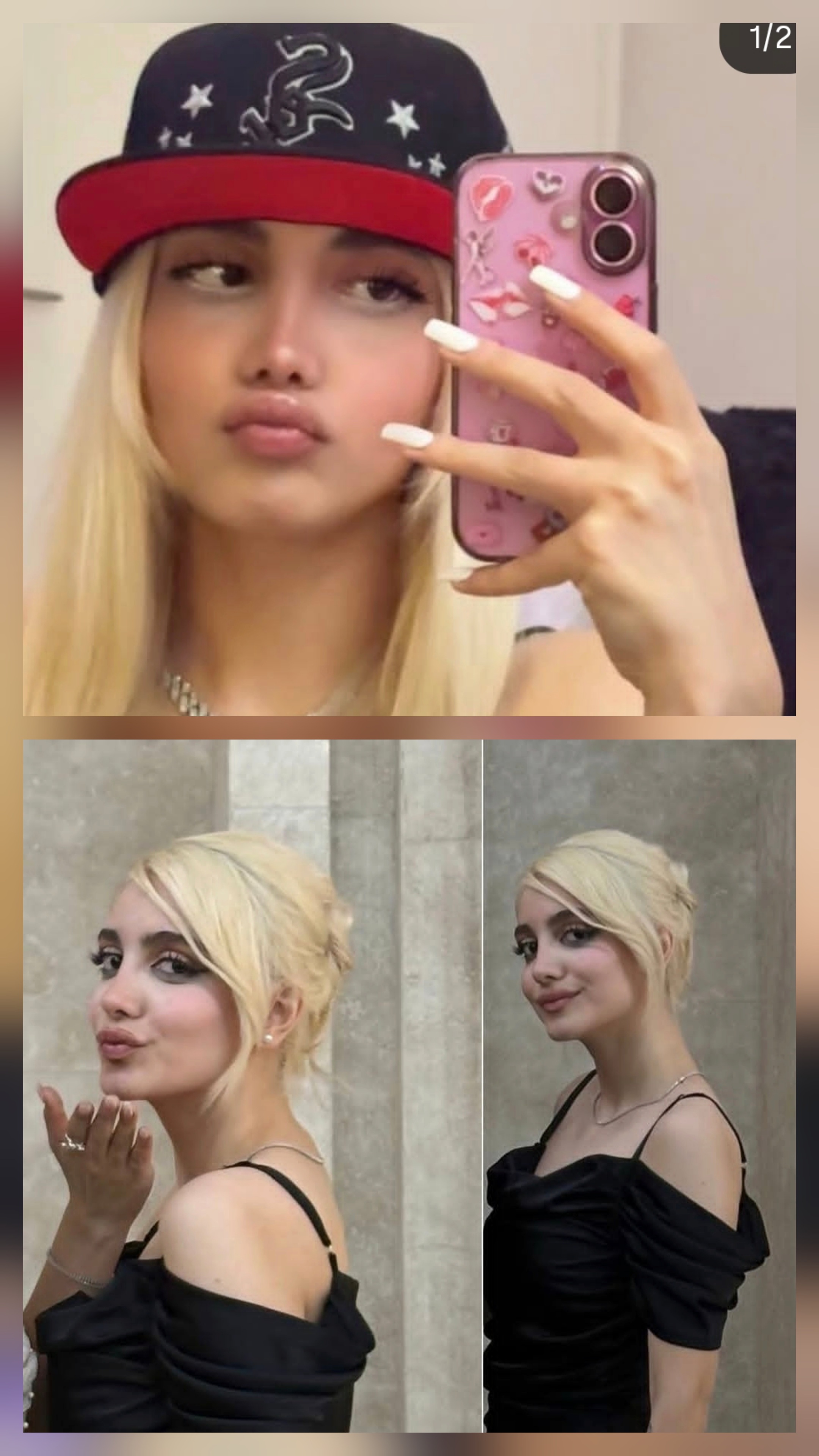 سه ماه بعد از عمل