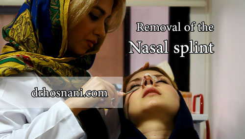 nasal splint3