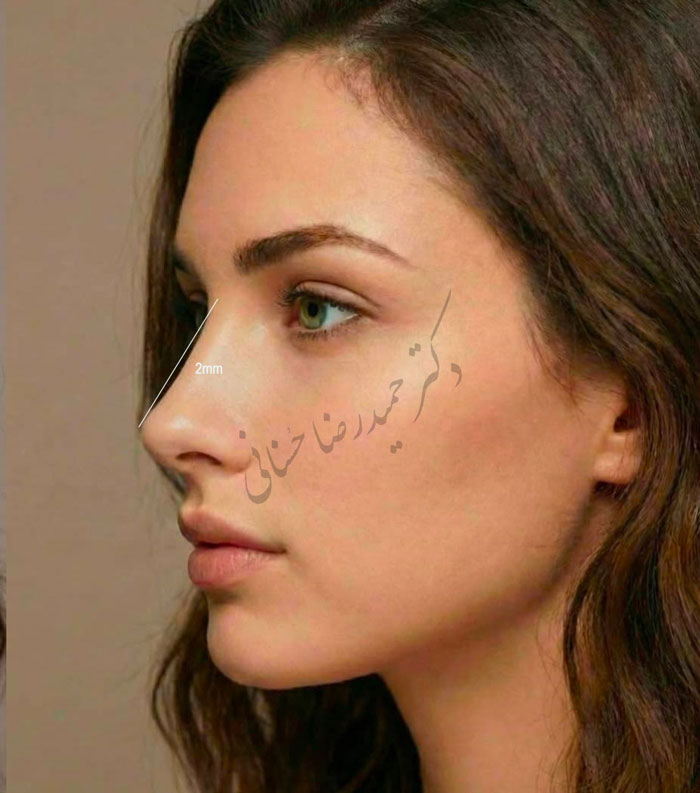 قانون ۲ میلی‌متر پشت بینی در زیبایی‌شناسی داوینچی