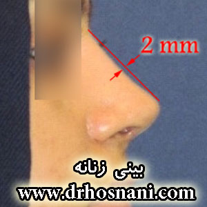 300 feminine nose