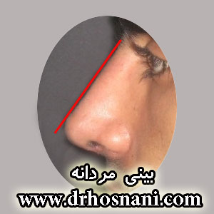 300 masculine nose
