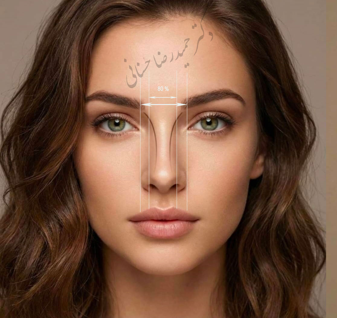 پهنای نوک بینی؛ ۸۰ درصد پهنای کل بینی