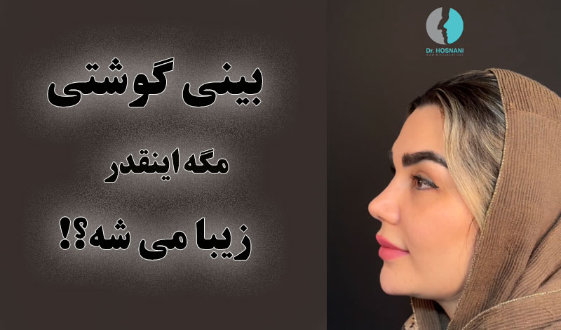بینی گوشتی مگه اینقدر خوب می شه؟