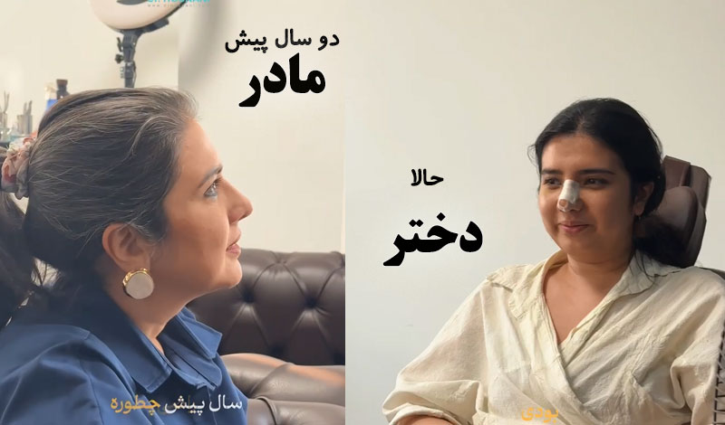 مادر دختری پیش دکتر حسنانی عمل کردند