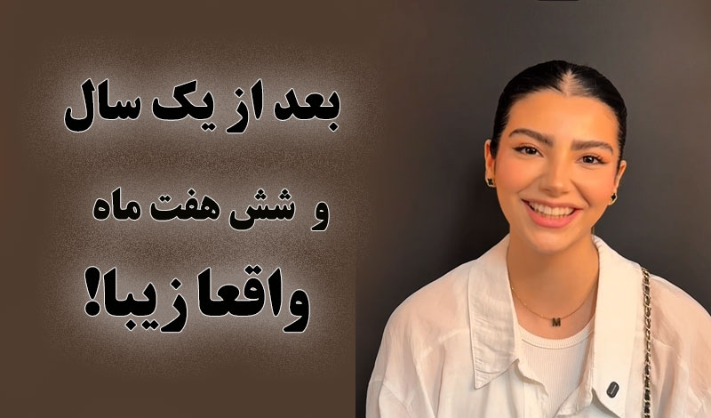 یک سال و شش هفت ماه بعد از جراحی. ببین چقدر خوشگل شده!