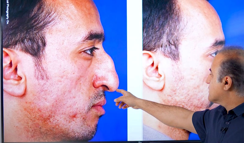 عمل بینی این آقا رو دیدی؟ معلوم نیست اصلاً جراحی کرده!