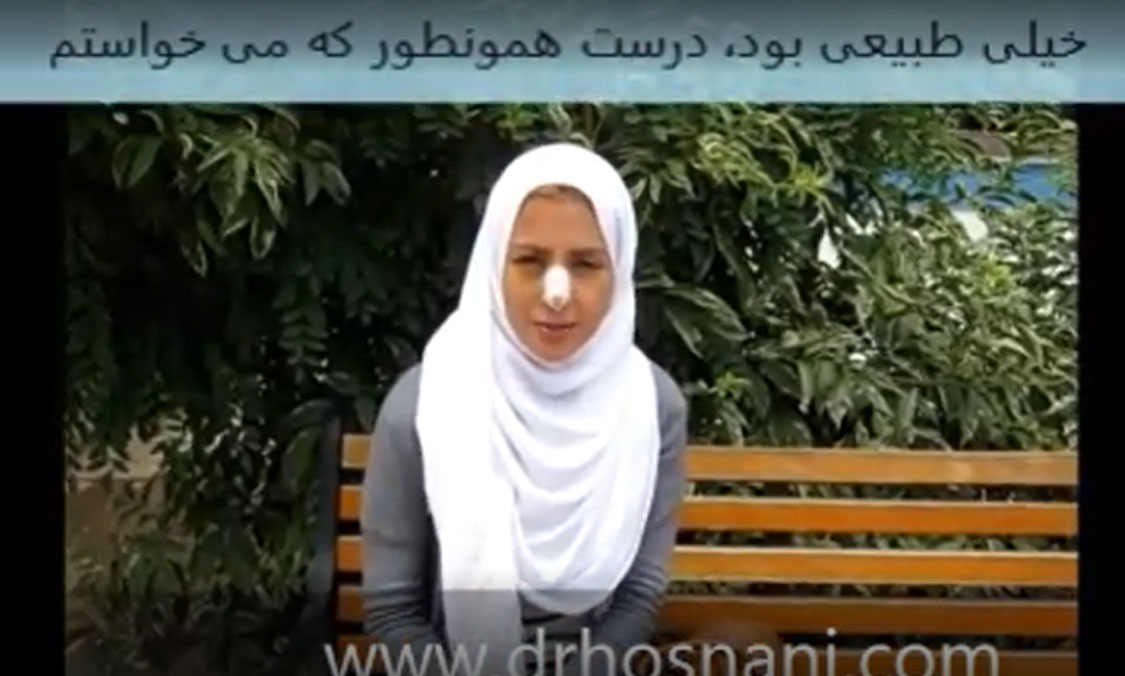 آمال یک هفته بعد از عمل بینی