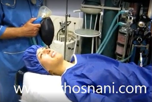 amal before anesthesia