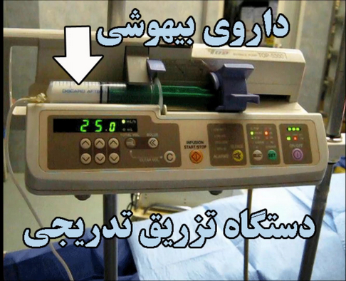 داروی بیهوشی، دستگاه تزریق تدریجی