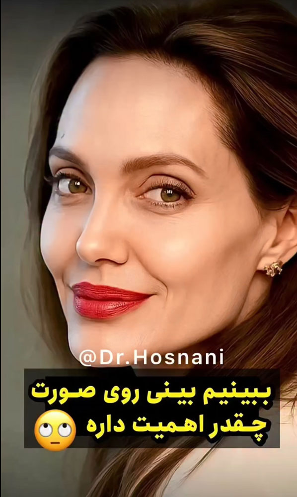 بینی روی صورت چقدر اهمیت داره