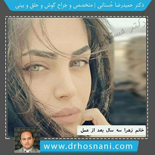 زهرا سه سال بعد از عمل