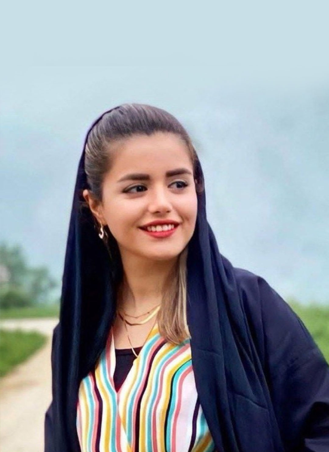 نمونه جراحی بینی دکتر حسنانی