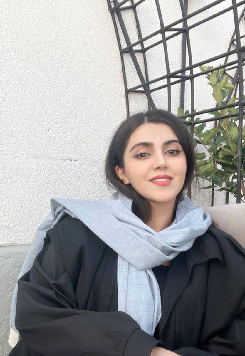 نمونه جراحی بینی دکتر حسنانی