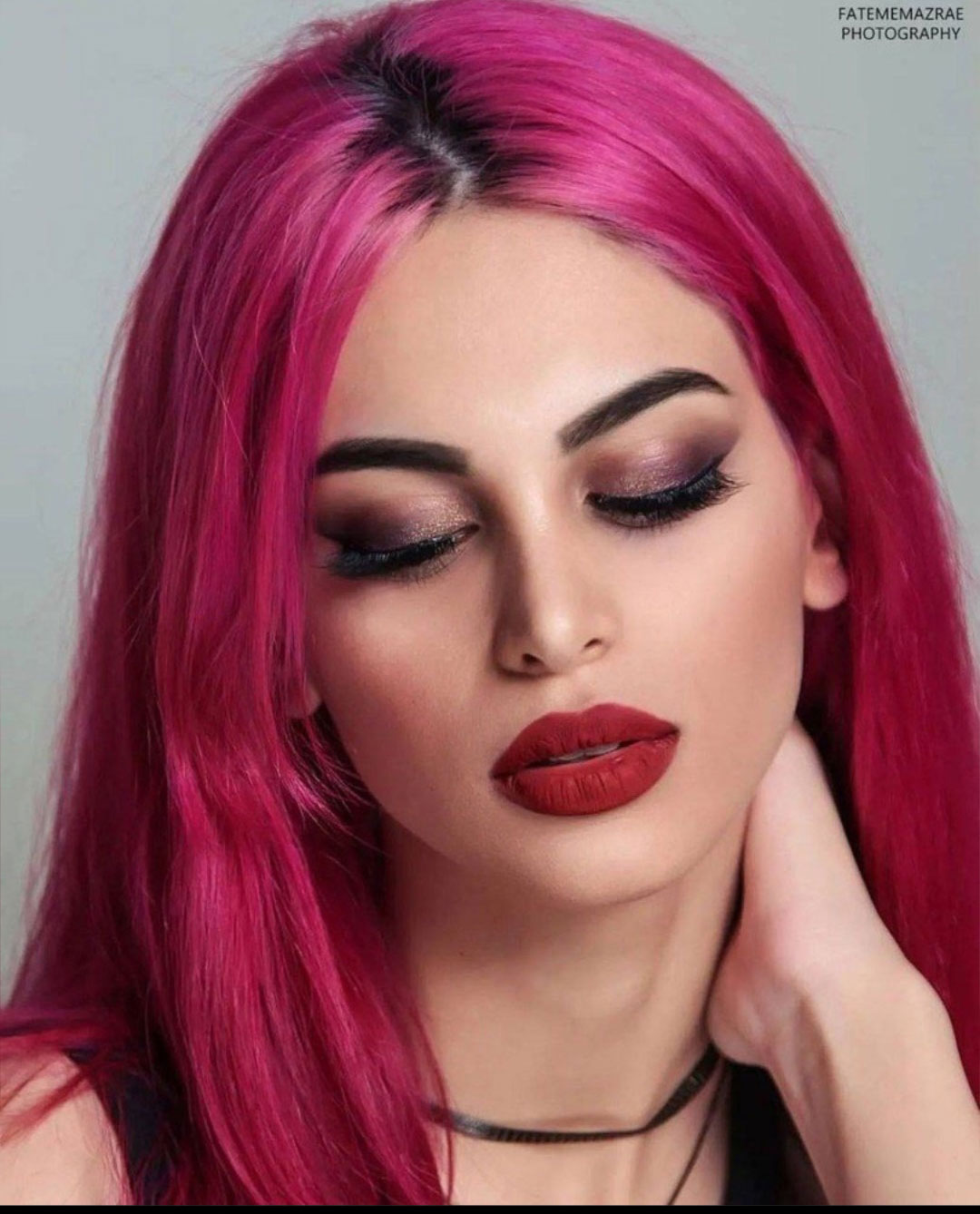 نمونه جراحی بینی دکتر حسنانی