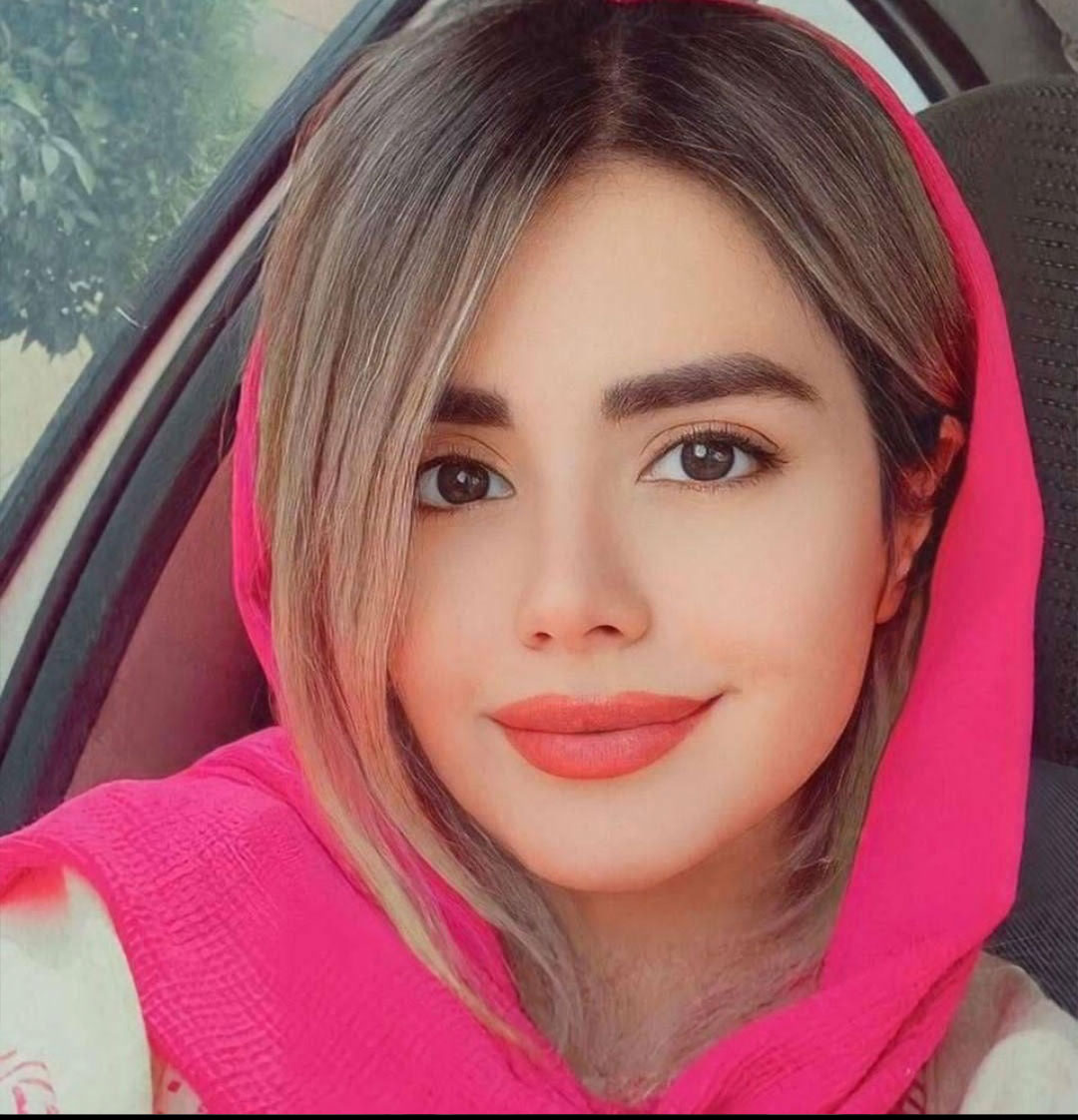 نمونه جراحی بینی دکتر حسنانی
