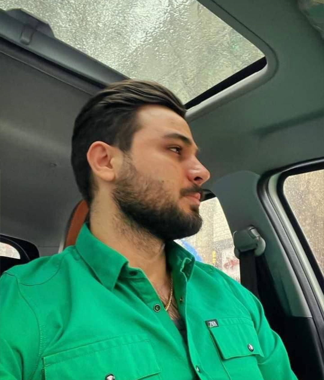 نمونه جراحی بینی دکتر حسنانی