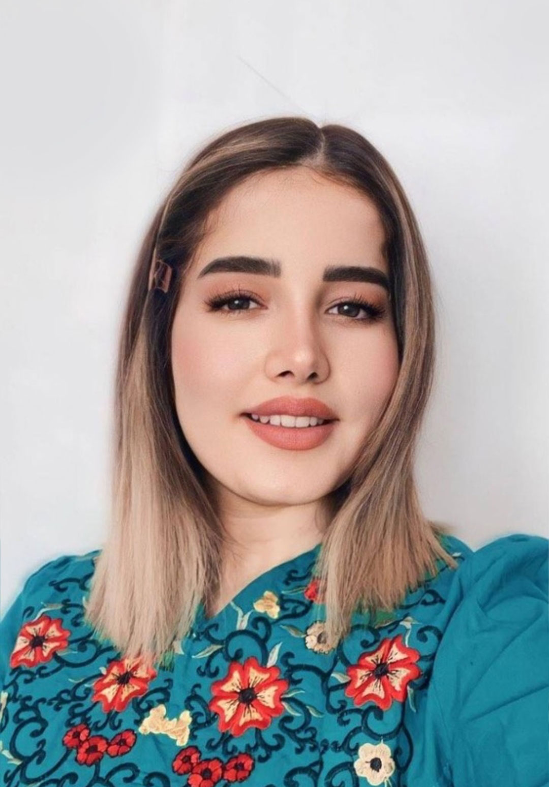 نمونه جراحی بینی دکتر حسنانی