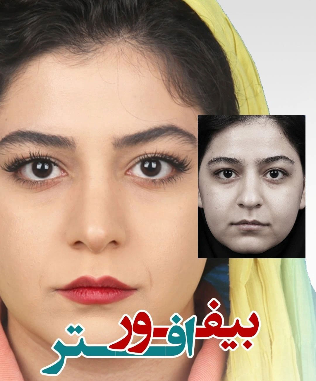 تناسب اجزاء بینی و تاثیر بینی در زیبایی