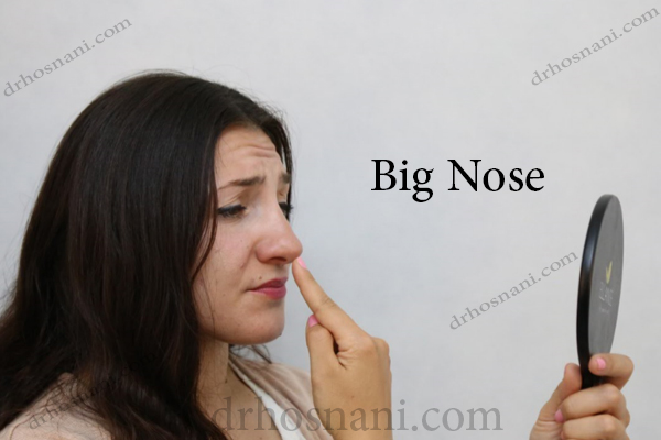 big nose