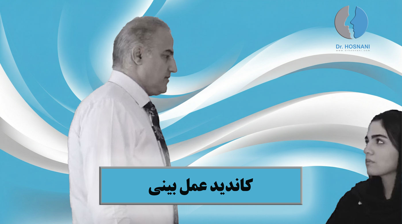 candidate for rhinoplasty