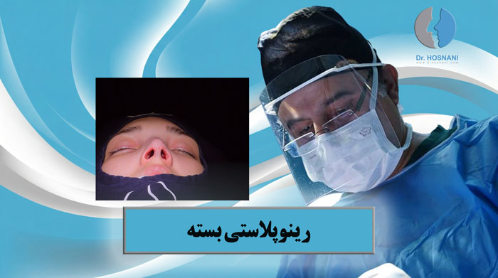 مزیت رینوپلاستی بسته