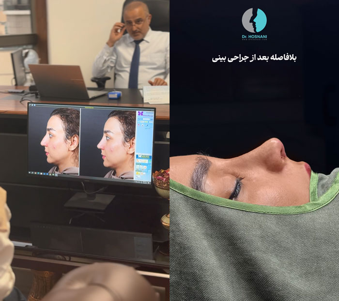 مقایسه نتیجه شبیه سازی کامپیوتری و نتیجه واقعی
