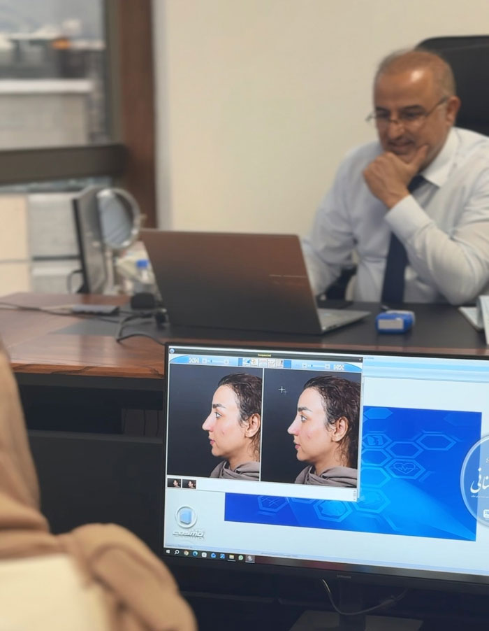 شبیه سازی کامپیوتری بینی