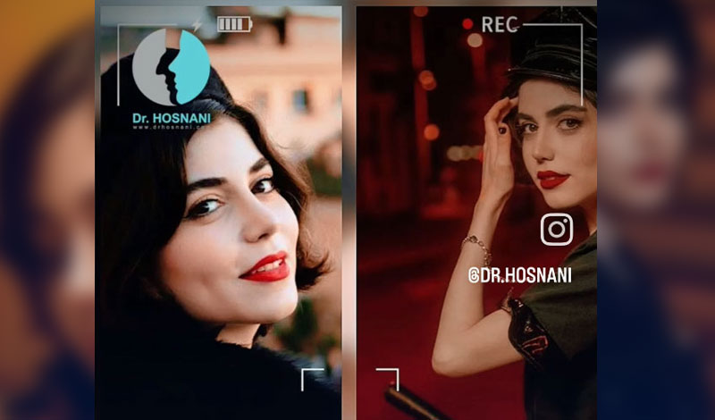لطفا به سبک دکتر حسنانی عمل بشه!