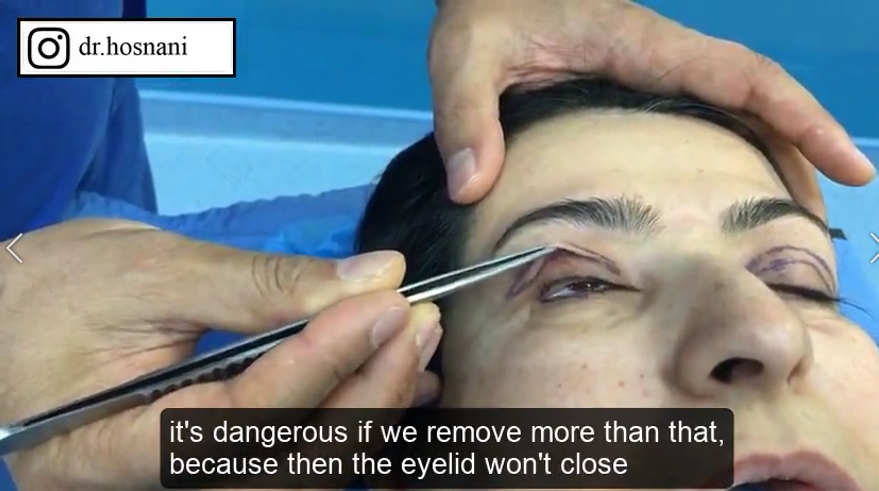 dangerous to remove more than this