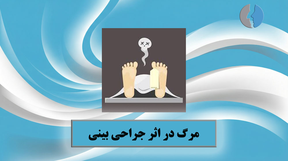 مرگ در اثر جراحی بینی
