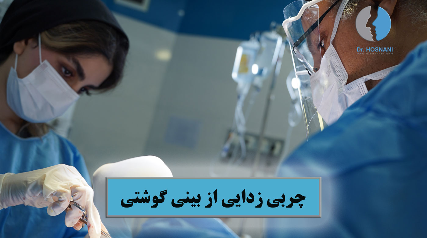 چربی زدایی از بینی گوشتی