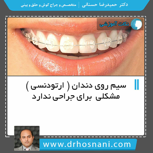 ارتودنسی و عمل بینی
