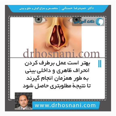 انحراف ظاهری و داخلی بینی