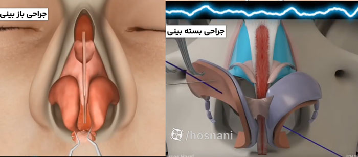 تفاوت روش باز و بسته در کاربرد
