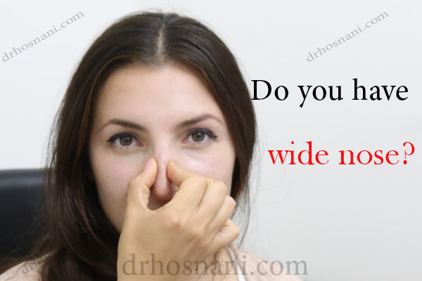 do you have a wide nose