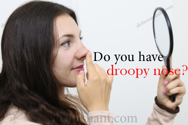 بینی افتاده