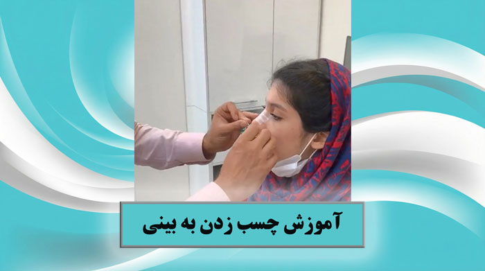 چسب زدن به بینی