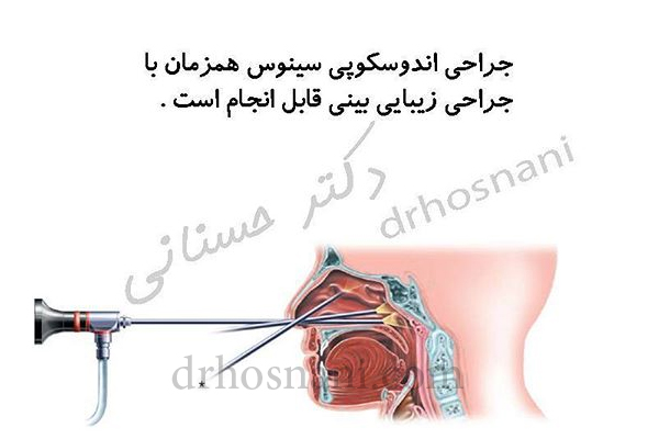 endoscopy