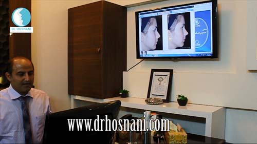 نتیجه طراحی کامپیوتری بینی