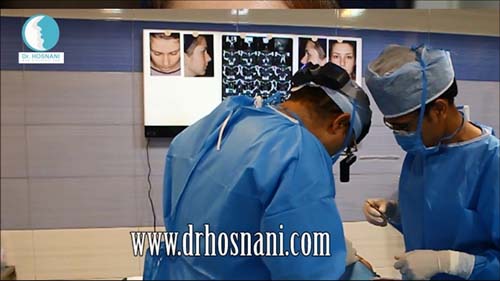 عکس سی تی اسکن بالای سر بیمار