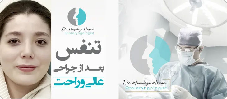 تنفس عالی و راحت بعد از جراحی بینی
