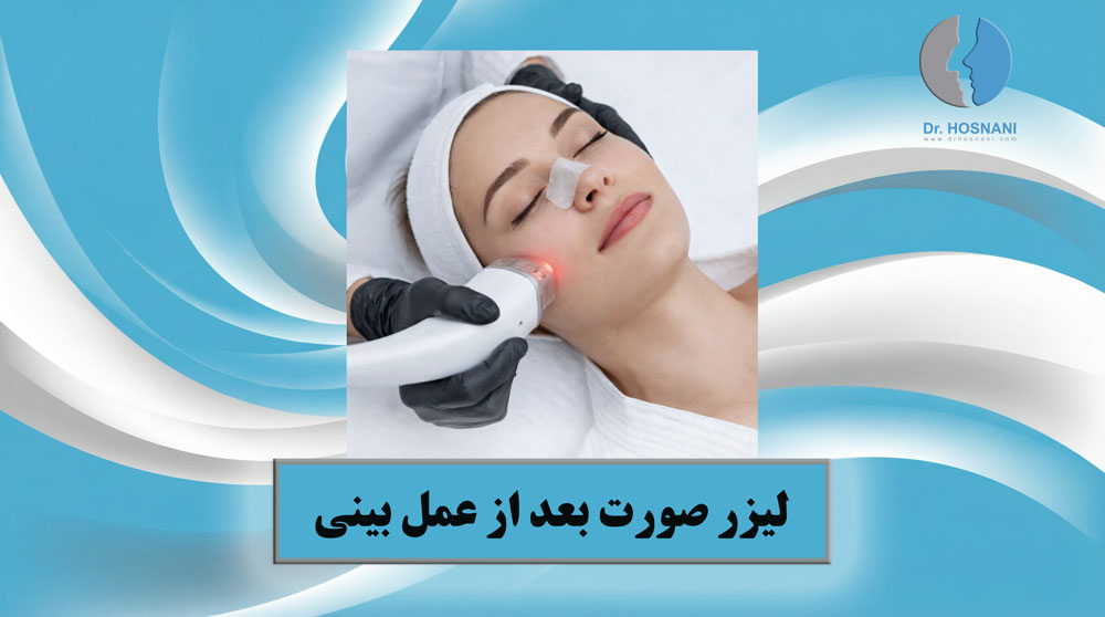 facial laser after rhinoplasty