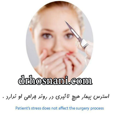 fear of rhinoplasty og