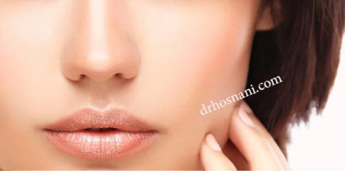 fleshy nose surgery og