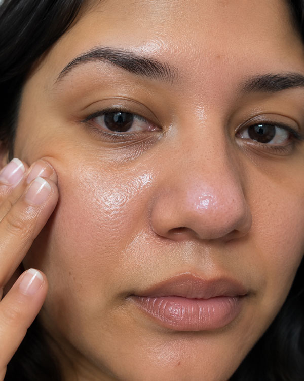 gloss of nasal skin after nosesurgery