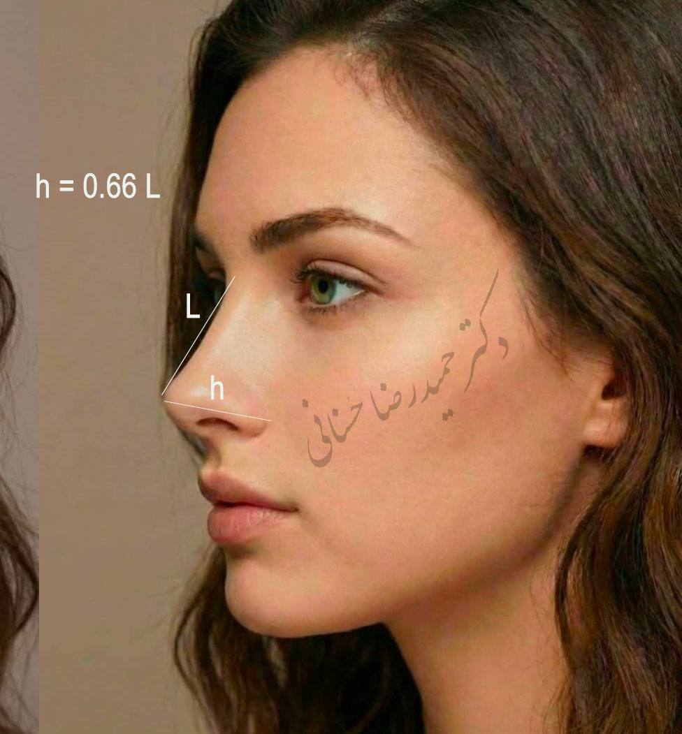 نسبت ارتفاع بینی به طول بینی