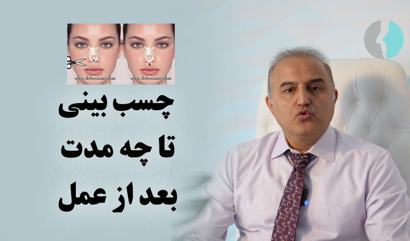 مدت زمان چسب زدن بینی