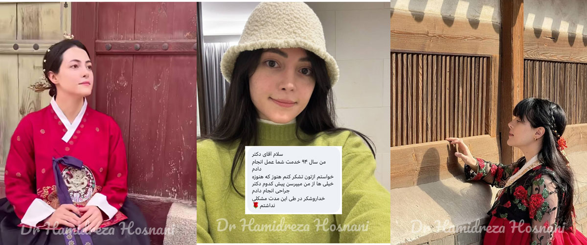 11 سال بعد ازعمل