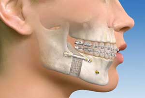 jaw